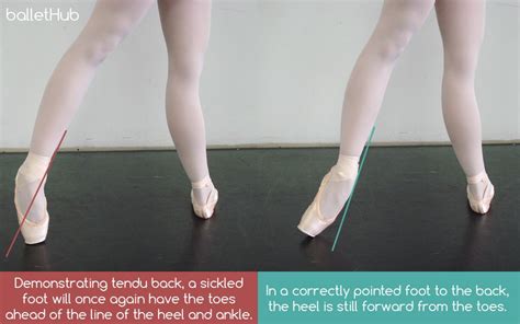 what is a sickled foot in dance